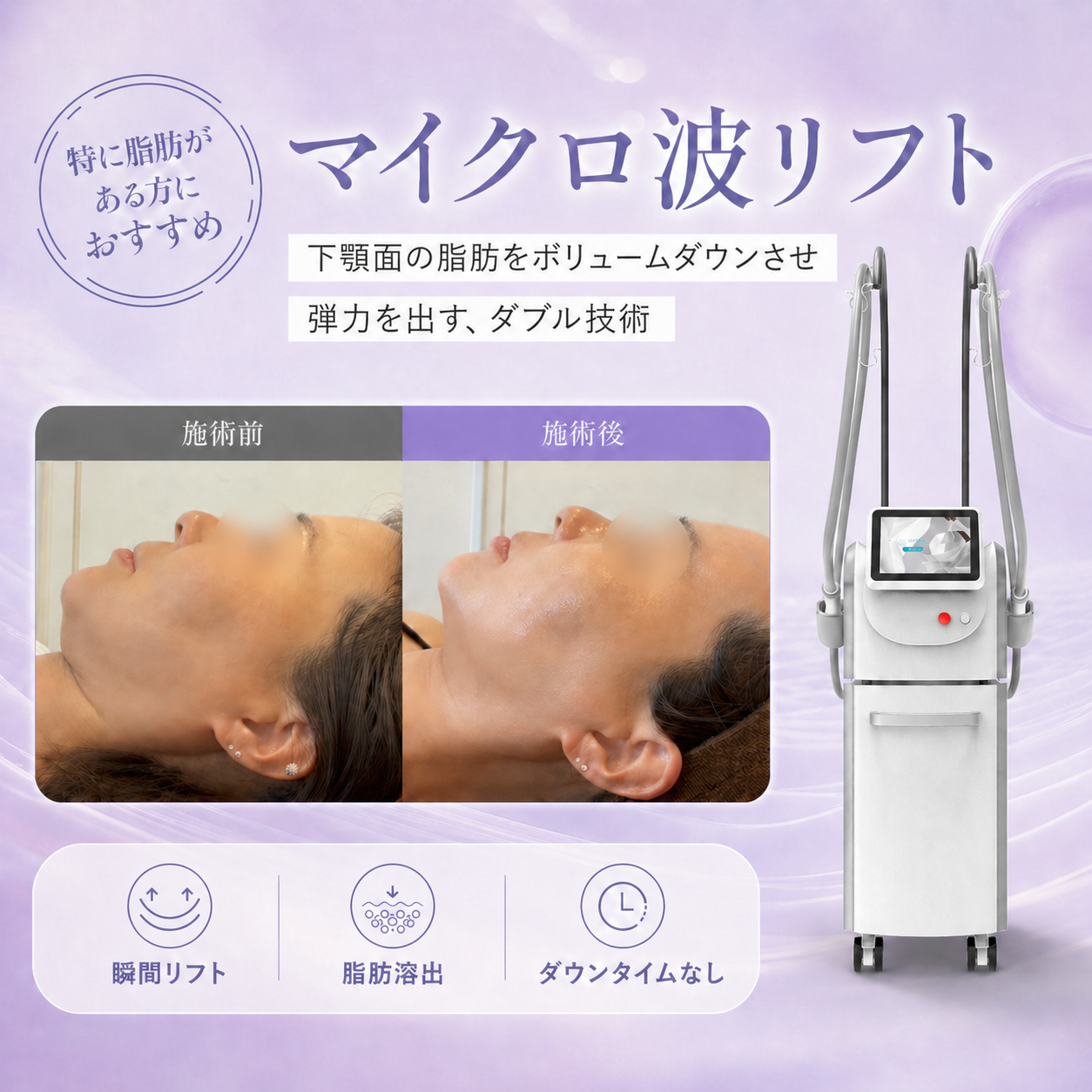 IMNDA（イミュンダ）【最新マイクロ波リフト機器】 – IMOMA Co.,Ltd