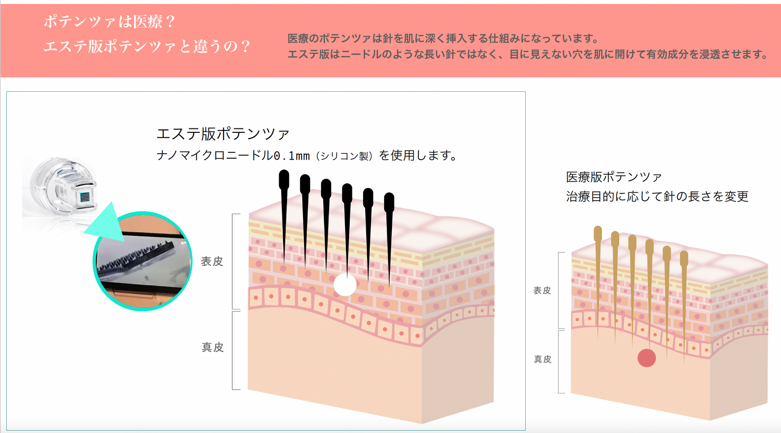 エステ版ポテンツァ(針なしなのマイクロニードル水光注射) – Diino エステ版ポテンツァ(針なしなのマイクロニードル水光注射) – Diino