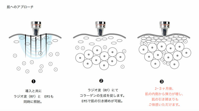 エステ版ポテンツァ（針なしなのマイクロニードル水光注射）